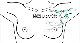 図）腋窩リンパ節